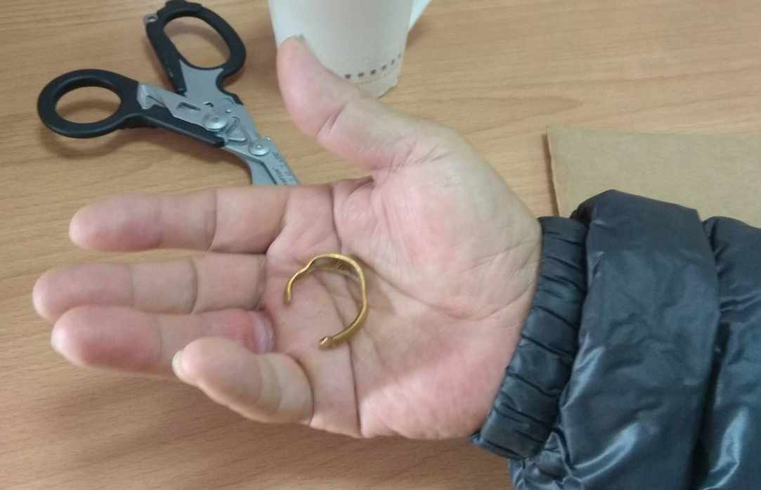 消防隊員剪斷金戒指後,老伯伯的手指重獲自由。 圖 : 嘉義市消防局/提供 消防隊員剪斷金戒指後,老伯伯的手指重獲自由。 圖 : 嘉義市消防局/提供