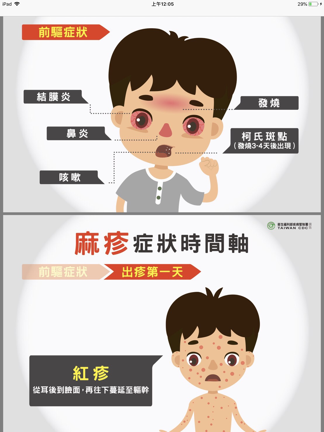 一旦感染麻疹,將出現發高燒、流鼻水、咳嗽、鼻炎、結膜炎等症狀,發燒3至4天後,口腔下臼齒的內頰側黏膜上,會出現典型的柯氏斑點。
圖:衛福部疾管署提供 一旦感染麻疹,將出現發高燒、流鼻水、咳嗽、鼻炎、結膜炎等症狀,發燒3至4天後,口腔下臼齒的內頰側黏膜上,會出現典型的柯氏斑點。
圖:衛福部疾管署提供