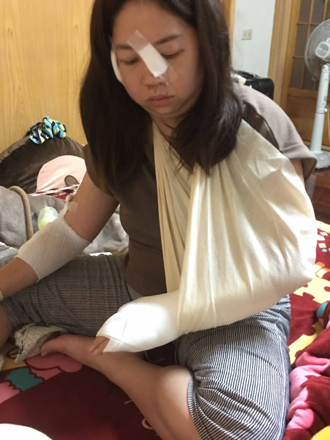 民眾租用ubike卻因不明原因車頭鎖死,結果騎士摔車受傷嚴重。 圖:梁為超議員服務處/提供 民眾租用ubike卻因不明原因車頭鎖死,結果騎士摔車受傷嚴重。 圖:梁為超議員服務處/提供