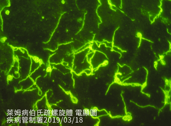 萊姆病伯氏疏螺旋體電顯圖。 圖:疾管署/提供 萊姆病伯氏疏螺旋體電顯圖。 圖:疾管署/提供