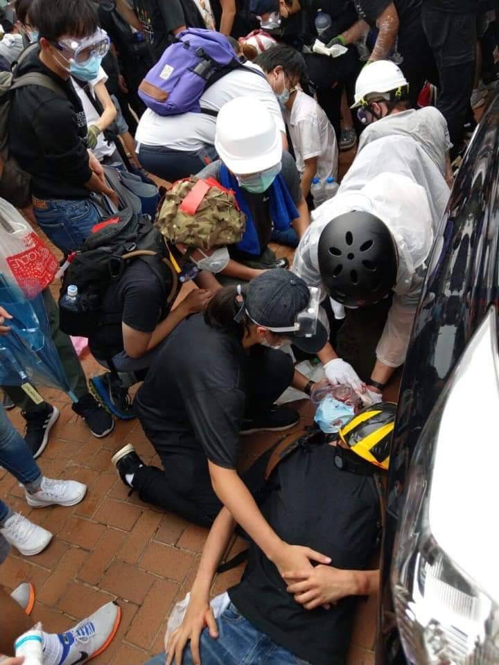 反送中抗爭現場,一位民眾眼睛遭港警擊中。 圖 : 翻攝自Leung Chi Wing 臉書 反送中抗爭現場,一位民眾眼睛遭港警擊中。 圖 : 翻攝自Leung Chi Wing 臉書