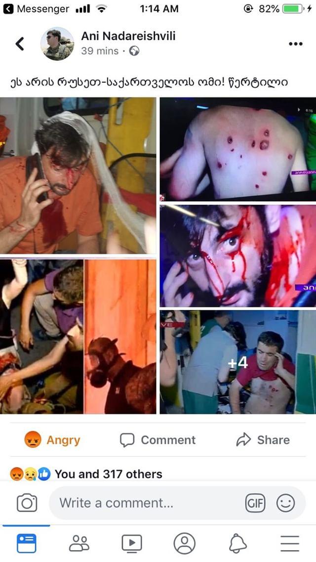 有民眾拍下遭橡膠子彈射中的抗議人士照片,滿臉是血,全身都是傷痕 圖:翻攝自Ani Nadarrishvili推特 有民眾拍下遭橡膠子彈射中的抗議人士照片,滿臉是血,全身都是傷痕 圖:翻攝自Ani Nadarrishvili推特