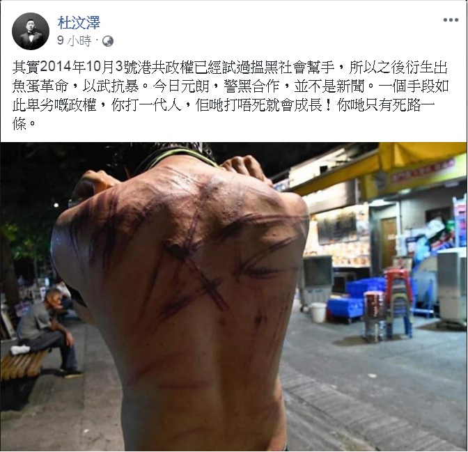 香港反送中爆發元朗白衣人無差別攻擊事件,港星杜汶澤也在PO出一張民眾背部傷痕累累照片,直指在元朗的白衣人根本是「警黑合作」。 圖:翻攝杜汶澤臉書 香港反送中爆發元朗白衣人無差別攻擊事件,港星杜汶澤也在PO出一張民眾背部傷痕累累照片,直指在元朗的白衣人根本是「警黑合作」。 圖:翻攝杜汶澤臉書