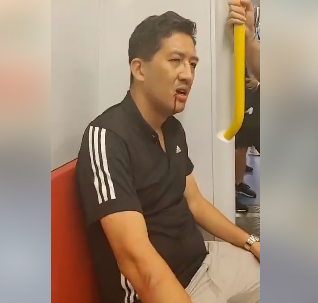 香港民主黨議員林卓廷遭白衣人士攻擊,嘴角濺血。 圖:翻攝自林卓廷臉書 香港民主黨議員林卓廷遭白衣人士攻擊,嘴角濺血。 圖:翻攝自林卓廷臉書