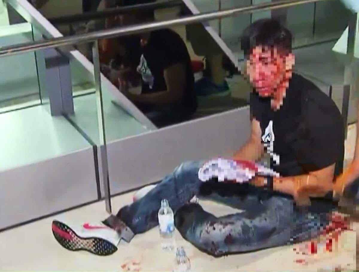香港反送中運動,元朗爆發白衣人無差別攻擊事件,受害者頭破血流。圖 : 翻社自香港巴打絲打臉書 by William Li 香港反送中運動,元朗爆發白衣人無差別攻擊事件,受害者頭破血流。圖 : 翻社自香港巴打絲打臉書 by William Li