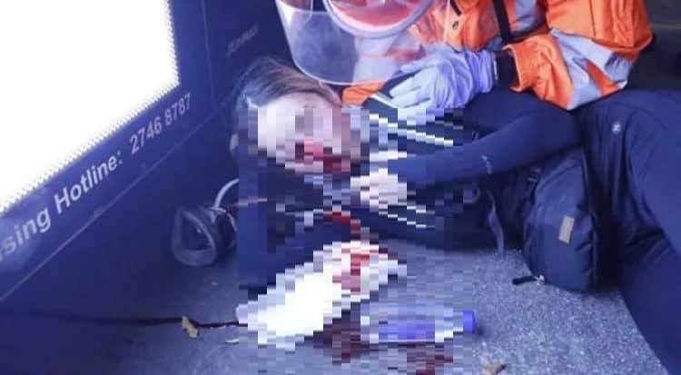 香港「反送中」行動持續,11日晚間傳出港警以布袋彈打穿護目鏡,創傷示威者右眼。 圖:翻攝桑普臉書 香港「反送中」行動持續,11日晚間傳出港警以布袋彈打穿護目鏡,創傷示威者右眼。 圖:翻攝桑普臉書