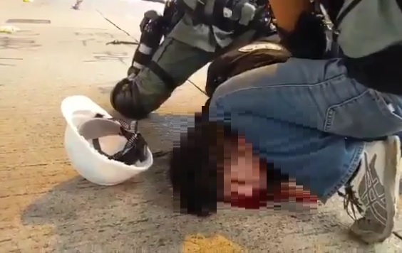 民眾遭港警攻擊,血流如注,惟港警仍將失血民眾強壓在地。 圖:翻攝自Alex Cheng 鄭思行臉書 民眾遭港警攻擊,血流如注,惟港警仍將失血民眾強壓在地。 圖:翻攝自Alex Cheng 鄭思行臉書