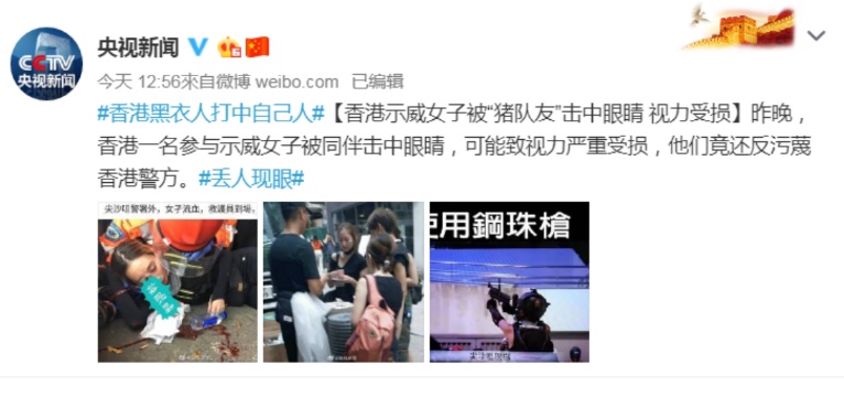 11日晚間,有一名女子眼部遭港警以布袋彈射擊,布袋彈射穿眼罩,緊急送醫後傳出右眼永久失明,然而,中國官媒對此竟稱該名女子是遭「豬隊友」射擊,反批示威者汙衊香港警方。 圖:翻攝自央視 11日晚間,有一名女子眼部遭港警以布袋彈射擊,布袋彈射穿眼罩,緊急送醫後傳出右眼永久失明,然而,中國官媒對此竟稱該名女子是遭「豬隊友」射擊,反批示威者汙衊香港警方。 圖:翻攝自央視