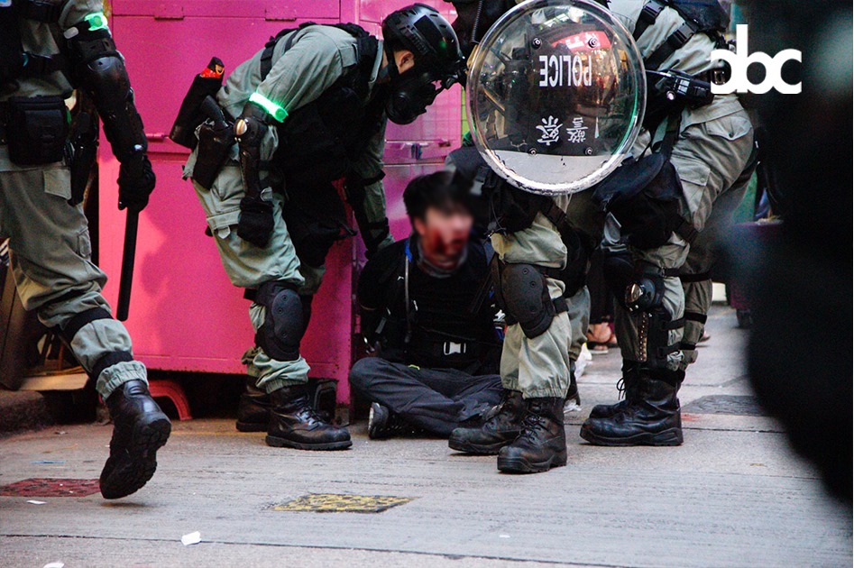 港島遊行,示威者與警方在金鐘夏愨道爆發衝突,一年青人遭警方逮捕,衝突過程中受傷。 圖:翻攝自城市廣播臉書。 港島遊行,示威者與警方在金鐘夏愨道爆發衝突,一年青人遭警方逮捕,衝突過程中受傷。 圖:翻攝自城市廣播臉書。