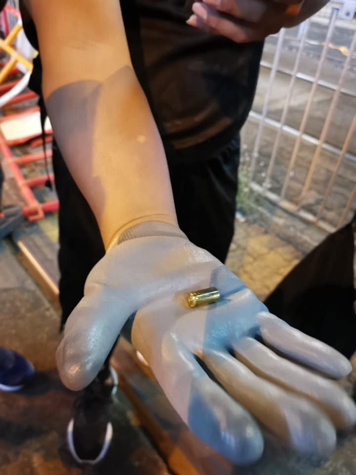 元朗發生14歲男童遭便衣警員開槍射傷左大腿事件。 圖:翻攝Tommy Cheung 張秀賢臉書 元朗發生14歲男童遭便衣警員開槍射傷左大腿事件。 圖:翻攝Tommy Cheung 張秀賢臉書