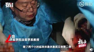 中國針對武漢肺炎死者進行遺體採樣,由同濟醫學院法醫學系教授劉良16日連續解剖2具遺體。 圖:翻攝自中國微博影片 中國針對武漢肺炎死者進行遺體採樣,由同濟醫學院法醫學系教授劉良16日連續解剖2具遺體。 圖:翻攝自中國微博影片