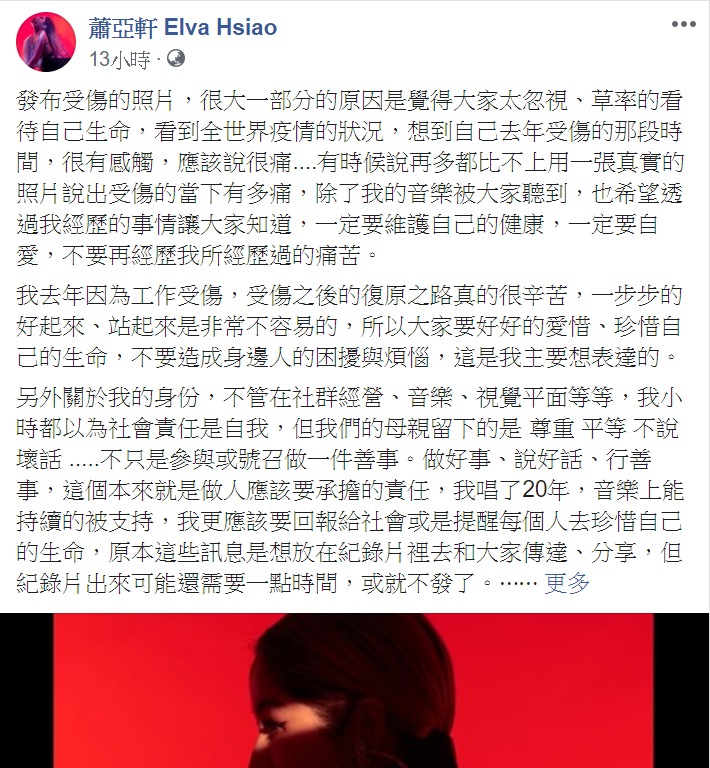 蕭亞軒今(7)日凌晨發文解釋為何貼出受傷照,呼籲大眾重視生命。 圖 : 翻攝自蕭亞軒臉書 蕭亞軒今(7)日凌晨發文解釋為何貼出受傷照,呼籲大眾重視生命。 圖 : 翻攝自蕭亞軒臉書