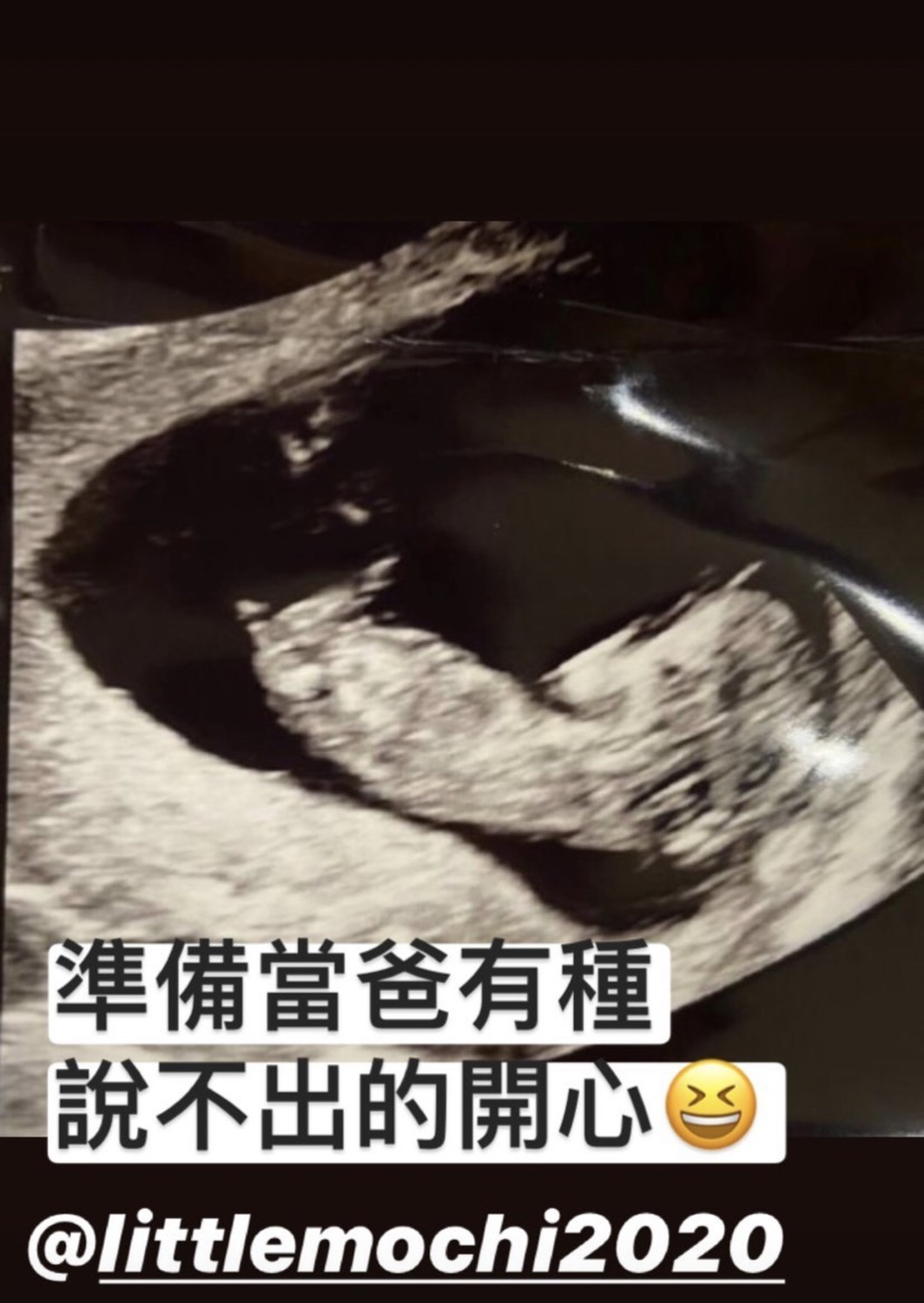 馬叔叔公佈小孩超音波照片。 圖:翻攝Instagram 馬叔叔公佈小孩超音波照片。 圖:翻攝Instagram