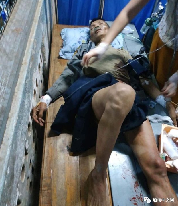 昨(5日)緬甸不明人士將一枚炸彈投擲到巡邏車上,炸死3名警察與1位民眾,截至目前為止共10人受傷。 圖 : 翻攝自緬甸中文網 昨(5日)緬甸不明人士將一枚炸彈投擲到巡邏車上,炸死3名警察與1位民眾,截至目前為止共10人受傷。 圖 : 翻攝自緬甸中文網