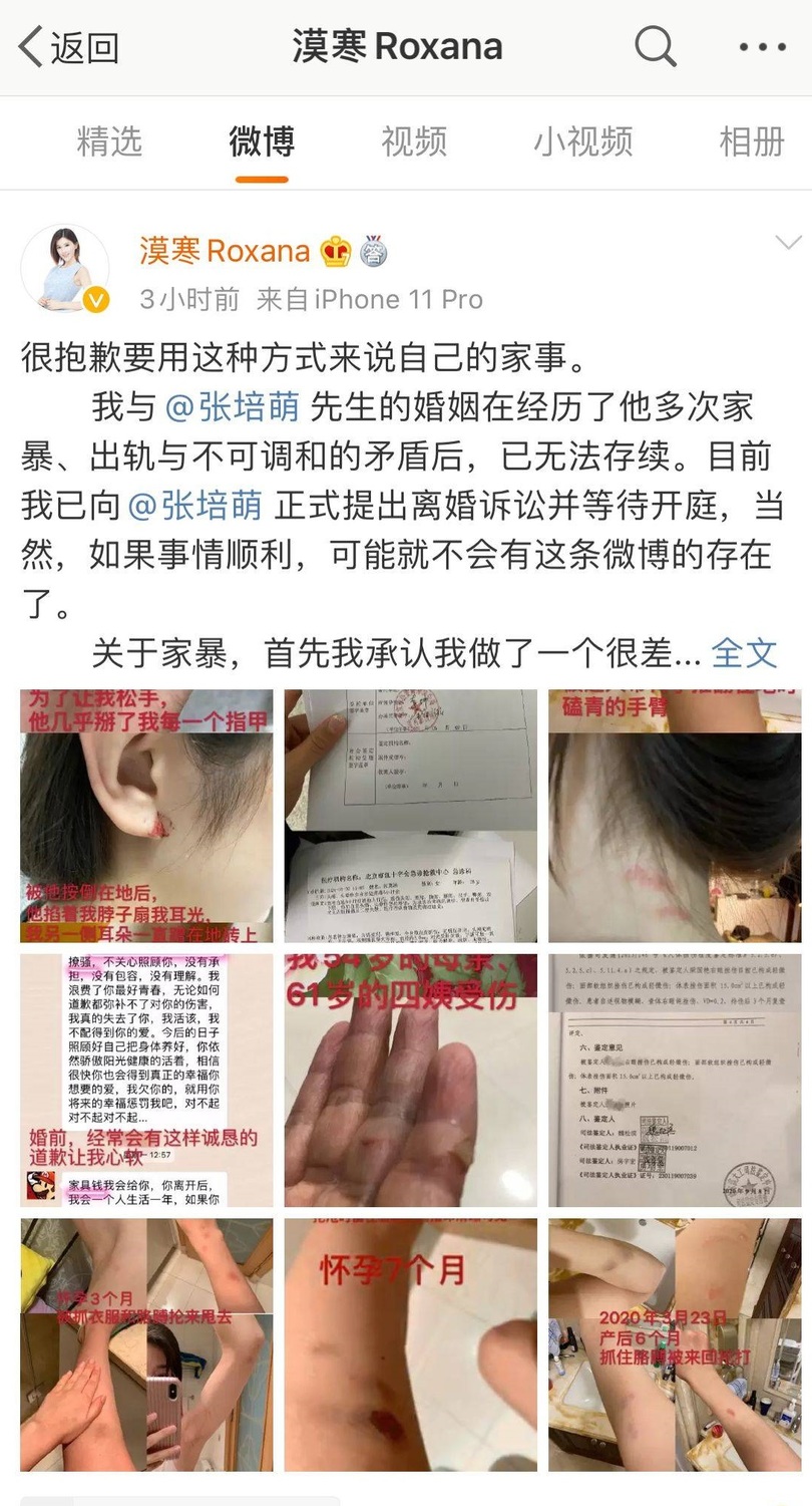 漠寒在微博發布長文控訴張培萌家暴、出軌,更曬出多張令人怵目驚心的驗傷照 圖:翻攝自 微博 漠寒在微博發布長文控訴張培萌家暴、出軌,更曬出多張令人怵目驚心的驗傷照 圖:翻攝自 微博