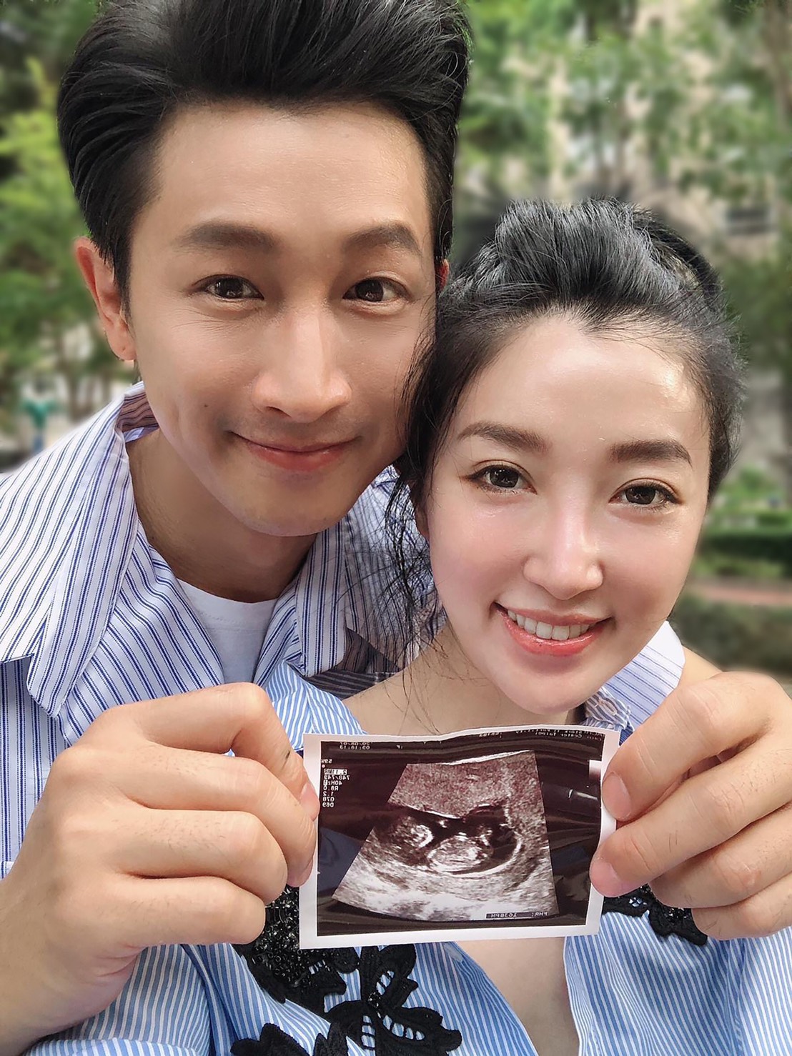 《婆婆》Darren宣布當爸！求子5年未果 初聽兒子心跳聲傻問：是什麼