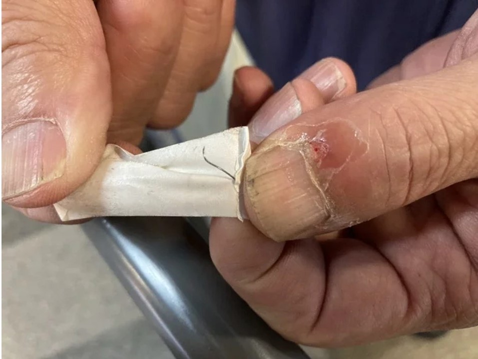 台鐵局表示,廠商查看後判斷為外力介入的針狀物,並非設備原有物。 圖:台鐵局/提供 台鐵局表示,廠商查看後判斷為外力介入的針狀物,並非設備原有物。 圖:台鐵局/提供