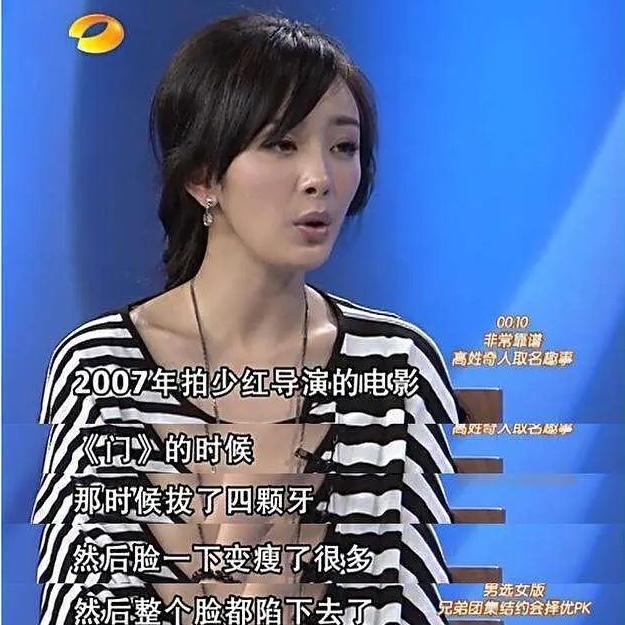 鄭爽直播問「誰說拔智齒可瘦臉？」 惹怒楊冪粉絲護主吵翻天