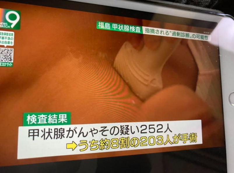 福島兒童有252人罹患甲狀腺癌,208人割除,這原本是百萬人才有二人而兒童只有1人會罹患的癌症。 圖 : 攝自NHK新聞 福島兒童有252人罹患甲狀腺癌,208人割除,這原本是百萬人才有二人而兒童只有1人會罹患的癌症。 圖 : 攝自NHK新聞