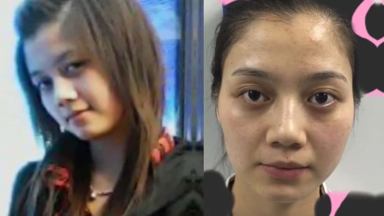 青青公開自己整型前的舊照,嚇壞網友。 圖:翻攝自微博 青青公開自己整型前的舊照,嚇壞網友。 圖:翻攝自微博