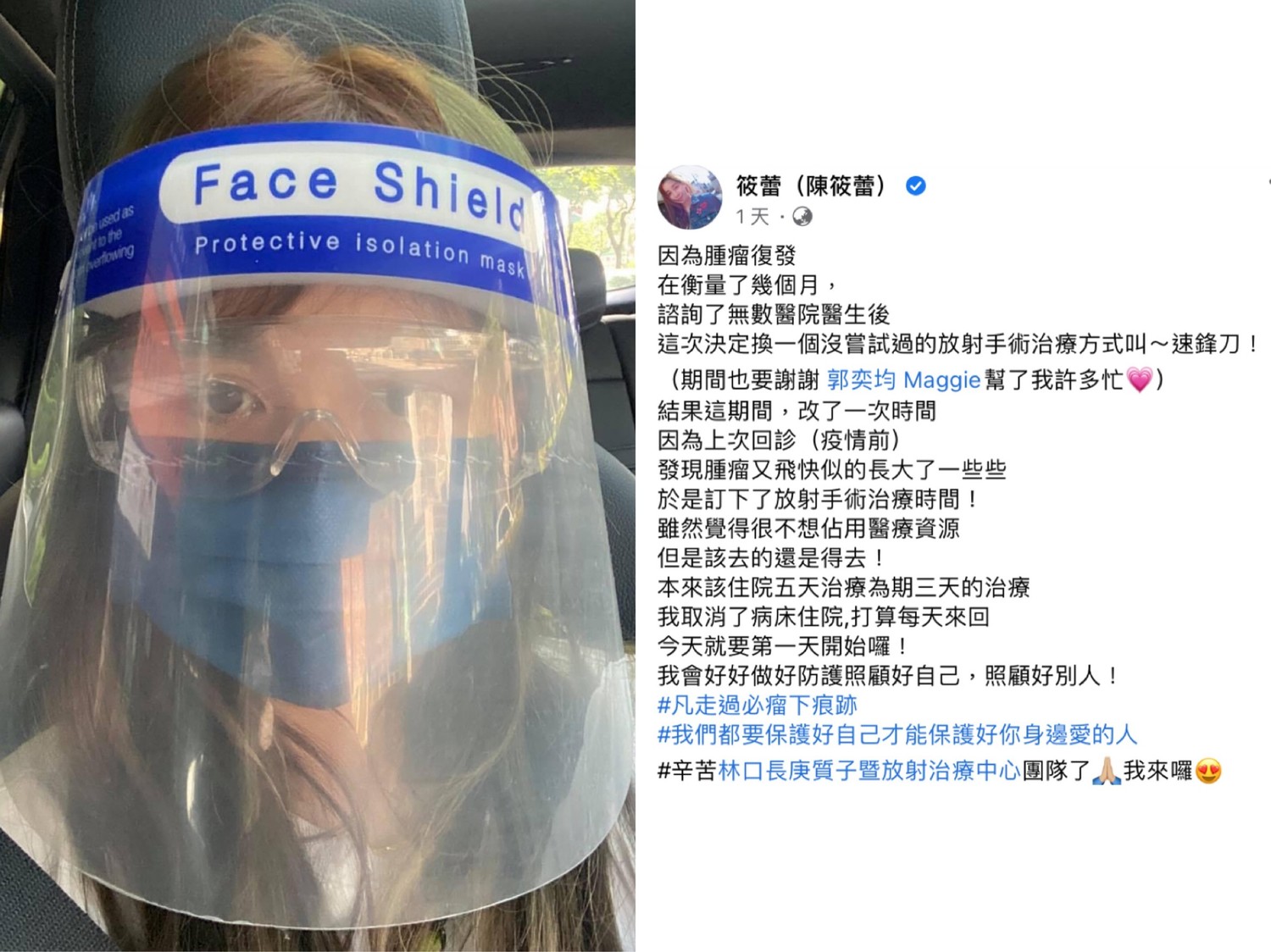 她透露自己要去做放射手術但不住院。 圖:翻攝自臉書 她透露自己要去做放射手術但不住院。 圖:翻攝自臉書