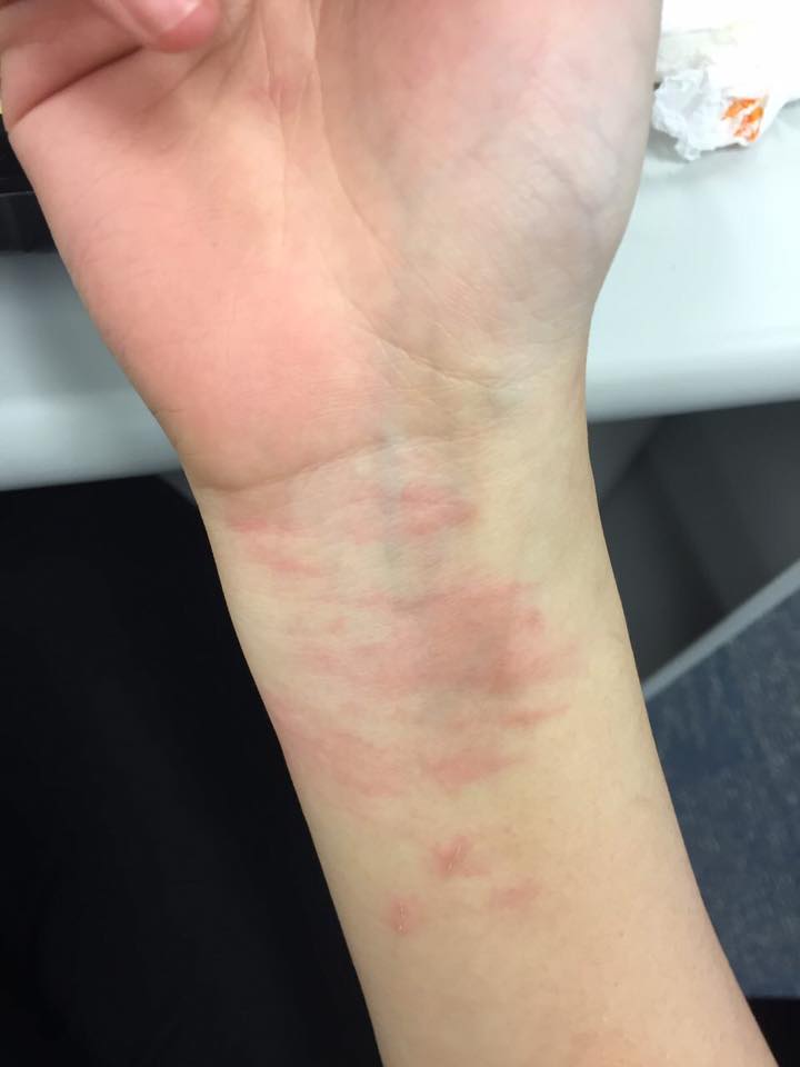 香港立法會議員梁恆頌在臉書上傳圖片,稱多位助理被打傷,更表示這是「CCTVB(中國中央電視台)不會看到的畫面」。 圖:翻攝梁恆頌臉書 香港立法會議員梁恆頌在臉書上傳圖片,稱多位助理被打傷,更表示這是「CCTVB(中國中央電視台)不會看到的畫面」。 圖:翻攝梁恆頌臉書
