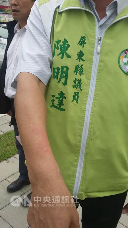總統府音樂會28日下午在屏東演藝廳舉行,年金改革抗 議團體聚集數百人抗議,音樂會結束後,民進黨籍屏東 縣議員劉育豪、陳明達等人在路邊等車,遭抗議群眾朝 他們丟瓶子,陳明達被丟到手臂淤傷。 (劉育豪提供) 中央社 圖:中央社 總統府音樂會28日下午在屏東演藝廳舉行,年金改革抗 議團體聚集數百人抗議,音樂會結束後,民進黨籍屏東 縣議員劉育豪、陳明達等人在路邊等車,遭抗議群眾朝 他們丟瓶子,陳明達被丟到手臂淤傷。 (劉育豪提供) 中央社 圖:中央社