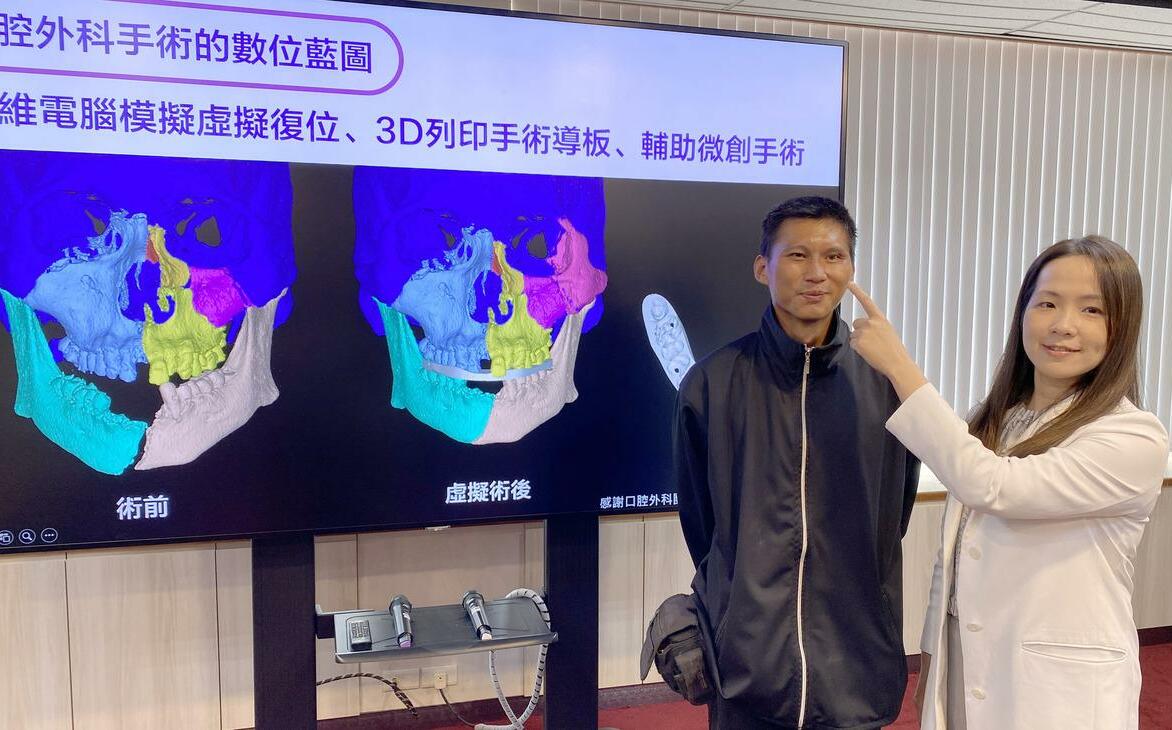 車禍後嚴重雙眼複視 台中榮總眼外肌移位手術 讓他看東西不再睜一眼閉一眼