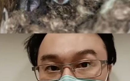 今年首例亡!漢他病毒可怕在初期「太像風寒」 胸腔醫點名這「4類人」最危險