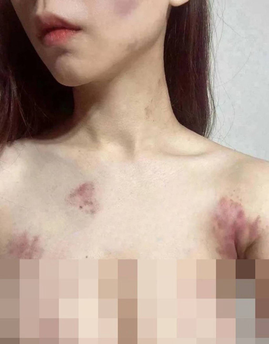 孔麗梅遭綁架後，犯罪集團奪走其手機，冒用其社群帳號向家屬及親友發送訊息，謊稱因賭博欠下巨額債務，要求支付 80 萬美元贖金，綁匪同步發出多張遭毆打受傷的照片。 圖:翻攝自X帳號@gz321123