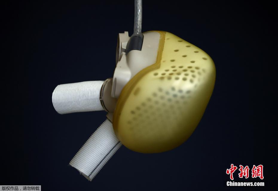 歐洲史上第一個獲准上市人工心臟 法國Carmat預計第二季推出