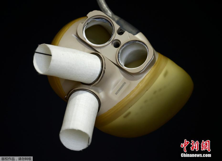 歐洲史上第一個獲准上市人工心臟 法國Carmat預計第二季推出