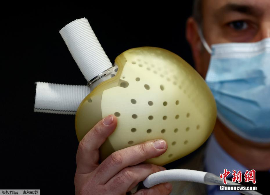 歐洲史上第一個獲准上市人工心臟 法國Carmat預計第二季推出
