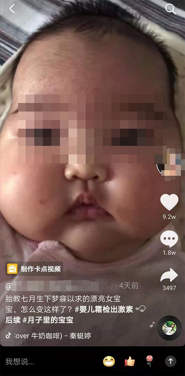 中國恐怖黑心嬰兒霜連環爆 家長痛心檢舉小孩使用後變「大臉娃娃」