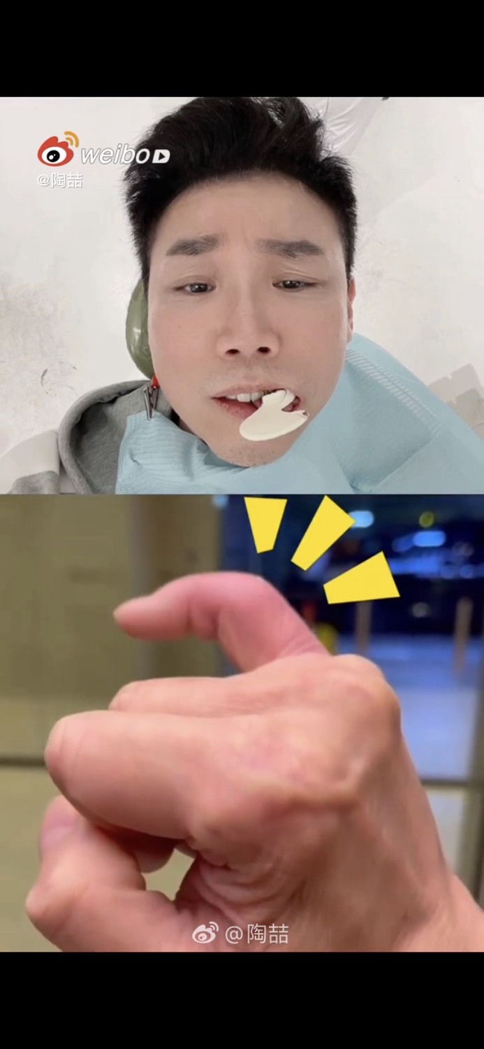 陶喆17日在微博曬出牙痛就診和右手小指紅腫的影片   圖：翻攝自微博
