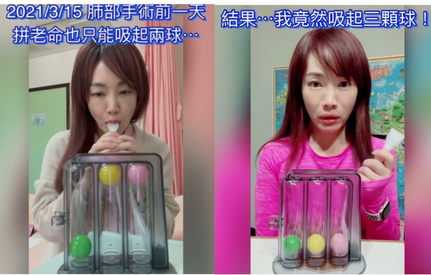 蕭彤雯肺腺癌術後每日走萬步復健！24天吹起3顆球感動落淚