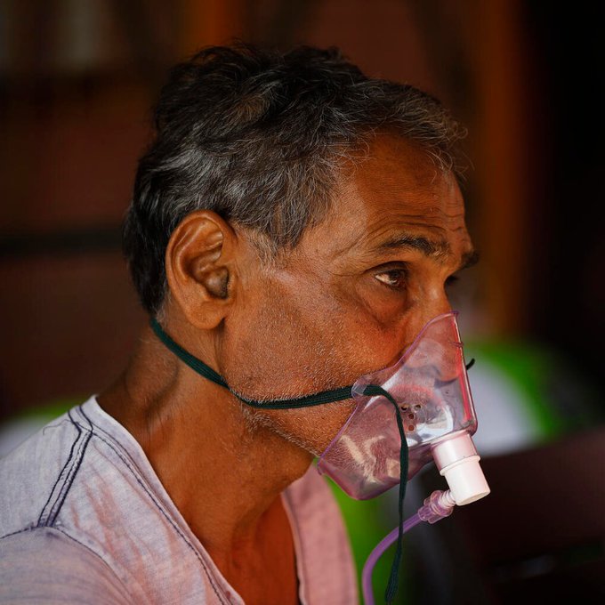 捨眼救命！印度武肺患者陷毛黴菌危機 死亡率過半