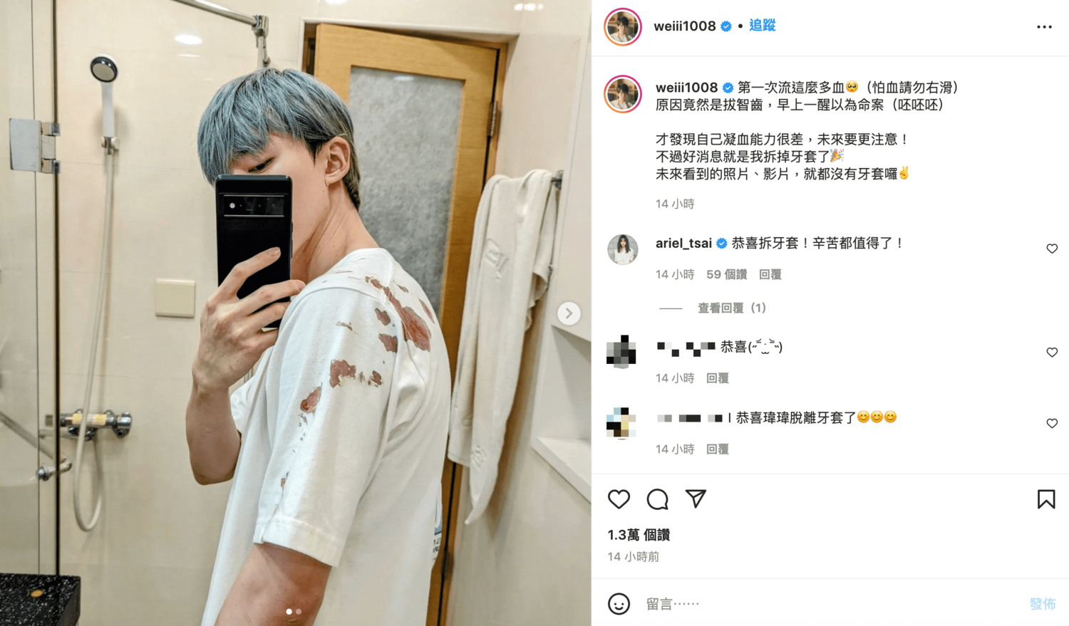 床上全是血！黃氏兄弟瑋瑋「血染」床單：以為命案
