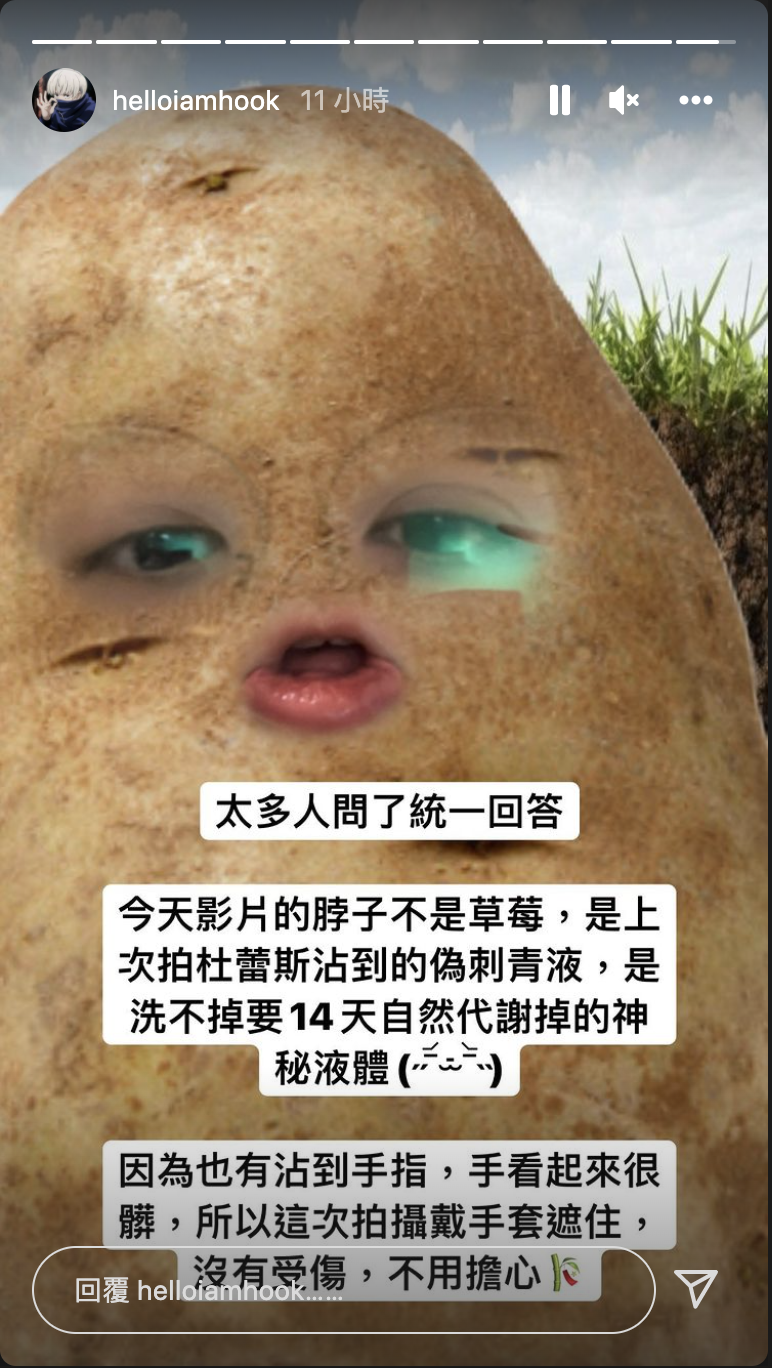 脖子被「種草莓」？HOOK私訊被灌爆 親上火線回應了…