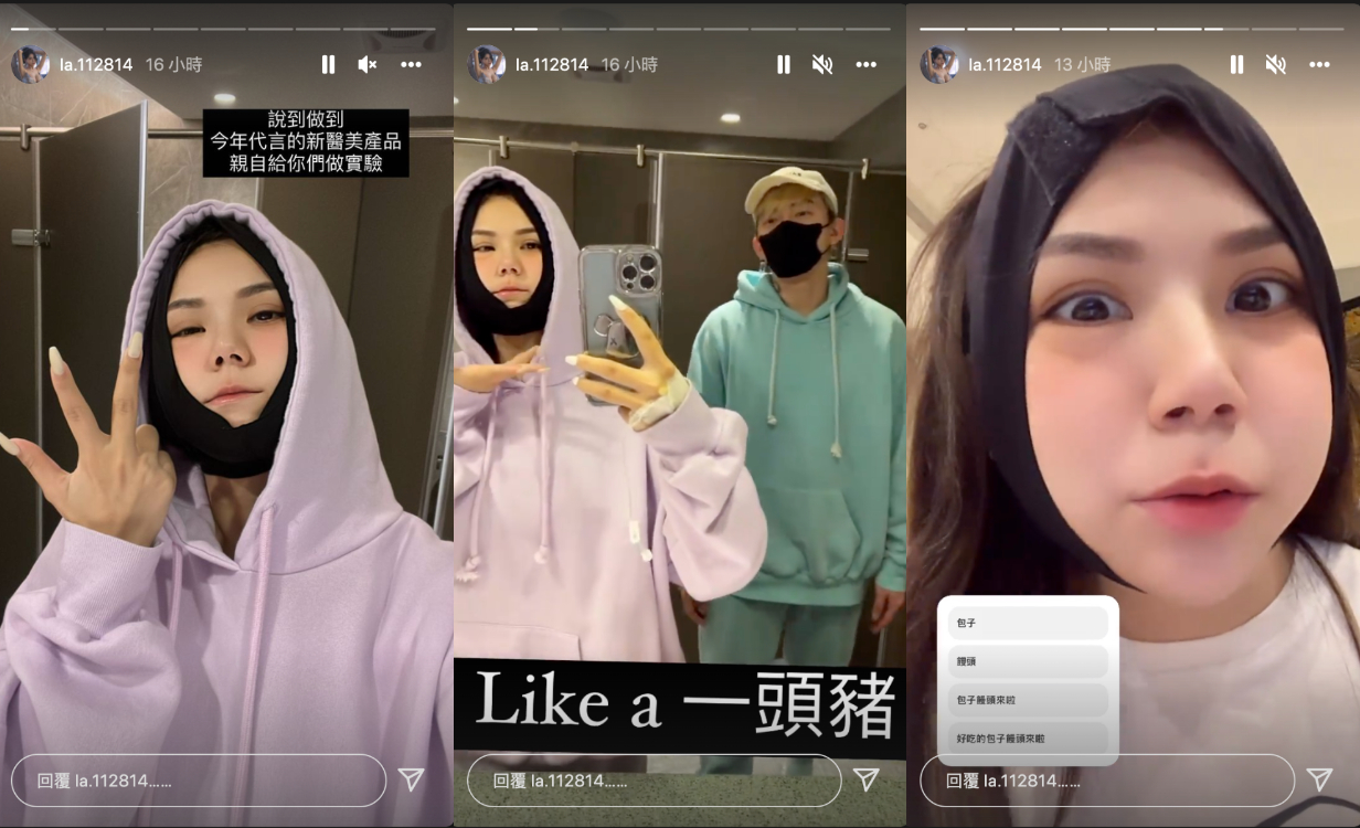 腫成豬頭！蕾菈曝「整形恢復期」慘樣 崩潰喊：明天更腫