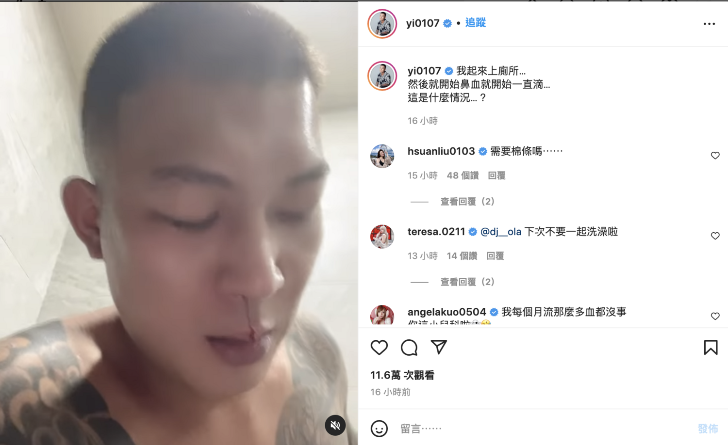 健康疑亮紅燈！鳳梨上廁所突「鼻血狂噴」急問：什麼情況？