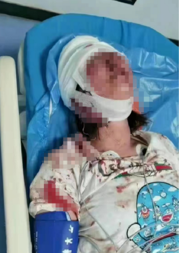 (影) 中國性暴力事件頻傳 唐山女遭圍毆引眾怒 外媒再提鐵鍊女與彭帥