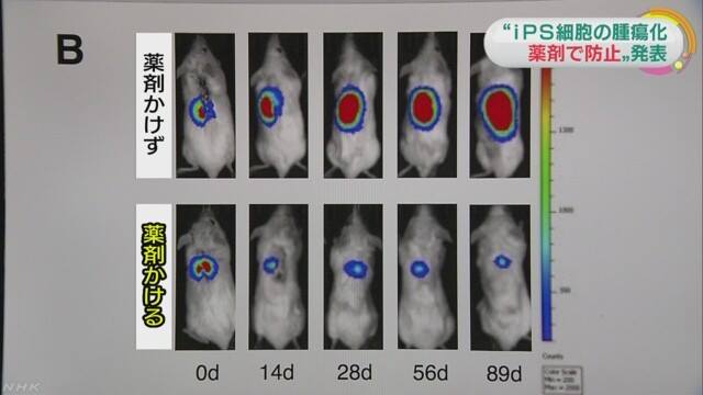 日發現特殊藥劑可防止ips細胞移植腫瘤化 生活 新頭殼newtalk