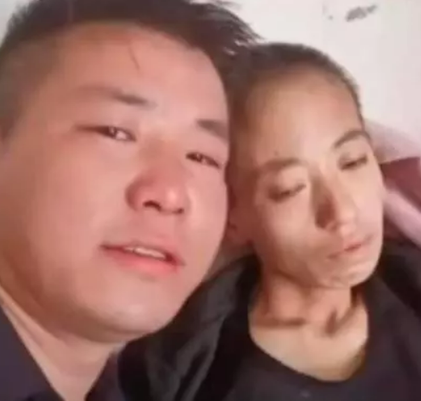 妻子罹癌遭丈夫直播詐財? 網批 : 放任她身體長蛆無人理