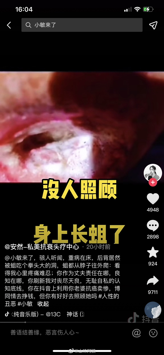 妻子罹癌遭丈夫直播詐財? 網批 : 放任她身體長蛆無人理