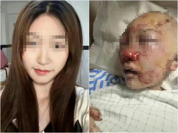 浙江20歲抖音網美「仙氣樂蘊」徐姓女子發文表示遭到不明男子埋伏襲擊。 圖:翻攝抖音 浙江20歲抖音網美「仙氣樂蘊」徐姓女子發文表示遭到不明男子埋伏襲擊。 圖:翻攝抖音