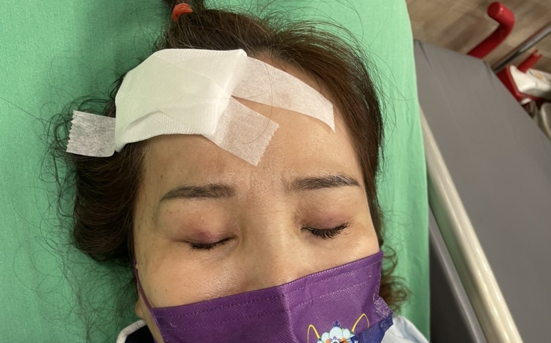 新黨議員候選人林婕麗遭攻擊 腦震盪住院 | 政治 | Newtalk新聞