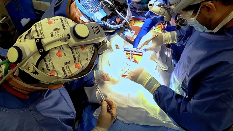 1月份，馬里蘭州巴爾的外科醫生將第一顆豬心臟移植到人體中。 圖：翻攝自《自然》雜誌網站