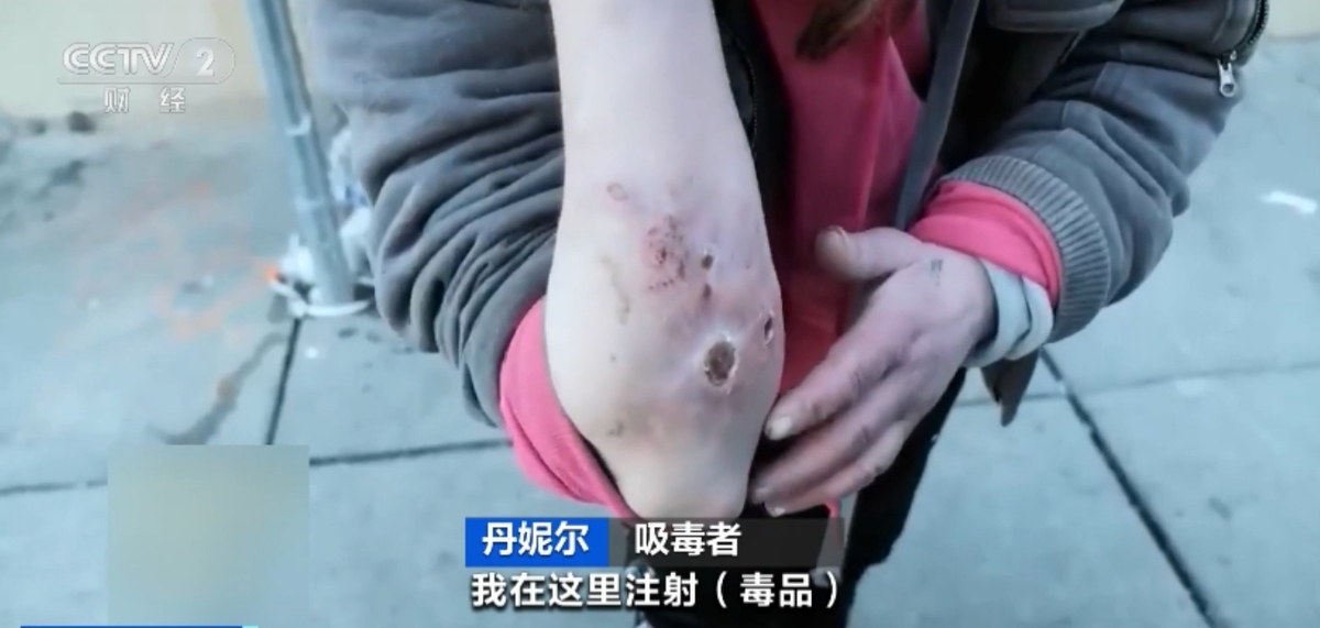  原先作為大型動物鎮靜劑的「賽拉嗪（Xylazine）」被加入古柯鹼和芬太尼（fentanyl）等常見毒品中，並且出現在了費城約 90%的吸毒者體內。 圖：擷取自中國《央視》 
