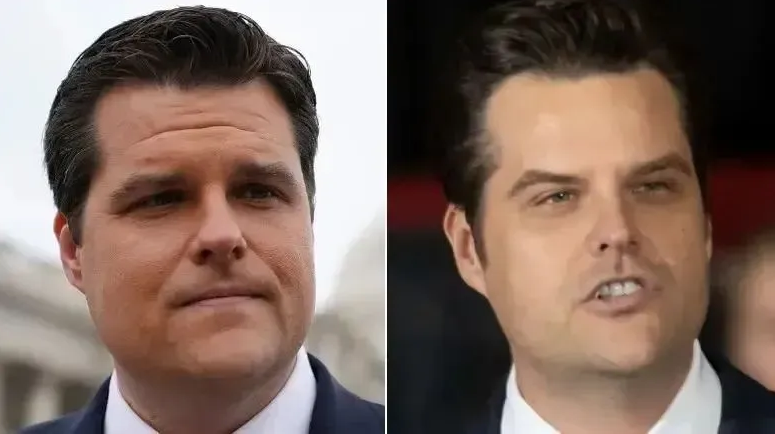 男性如眾議員馬特·蓋茨（Matt Gaetz）也傳出接受整形手術的消息。 圖:翻攝自南風窗